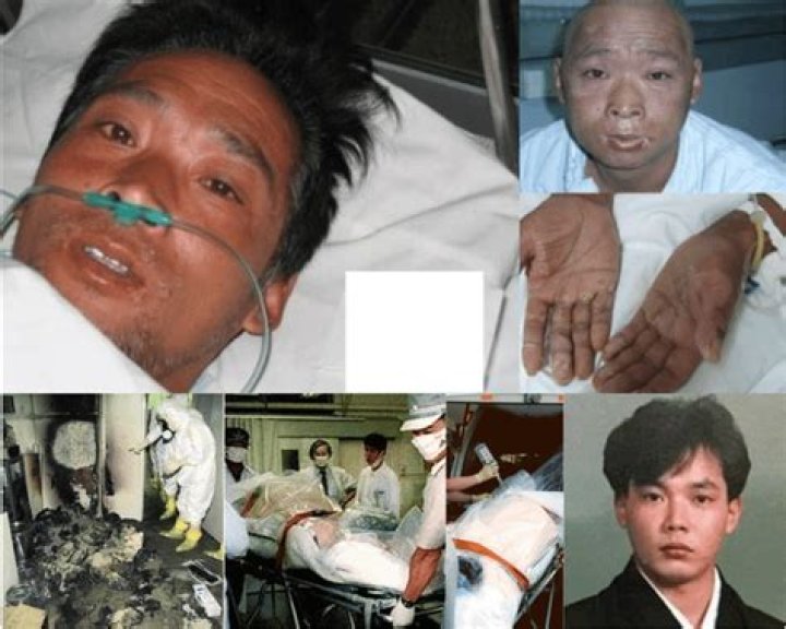 Hisashi Ouchi: The Man Who Survived the Worst Radiation Exposure in History